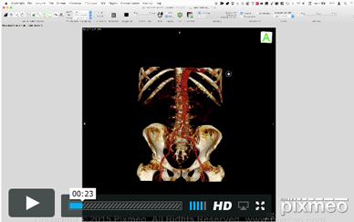 Osirix DICOM Viewer – Pediyatri